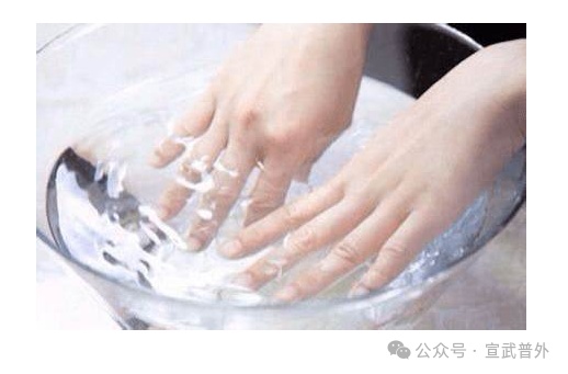 冻伤:正常处理,“急”时挺住 冻伤:正常处理,“急”时挺住