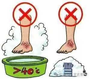 冻伤:正常处理,“急”时挺住 冻伤:正常处理,“急”时挺住