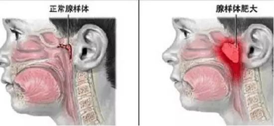 明星子女下巴后缩,为什么劝你“闭嘴”? 明星子女下巴后缩,为什么劝你“闭嘴”?