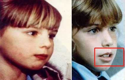 明星子女下巴后缩,为什么劝你“闭嘴”? 明星子女下巴后缩,为什么劝你“闭嘴”?