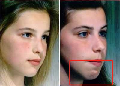 明星子女下巴后缩,为什么劝你“闭嘴”? 明星子女下巴后缩,为什么劝你“闭嘴”?