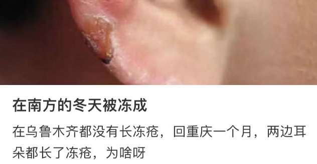 -2℃！冷冷冷！最近好多重庆人又遭了，网友：又痛又痒，好难根治……
