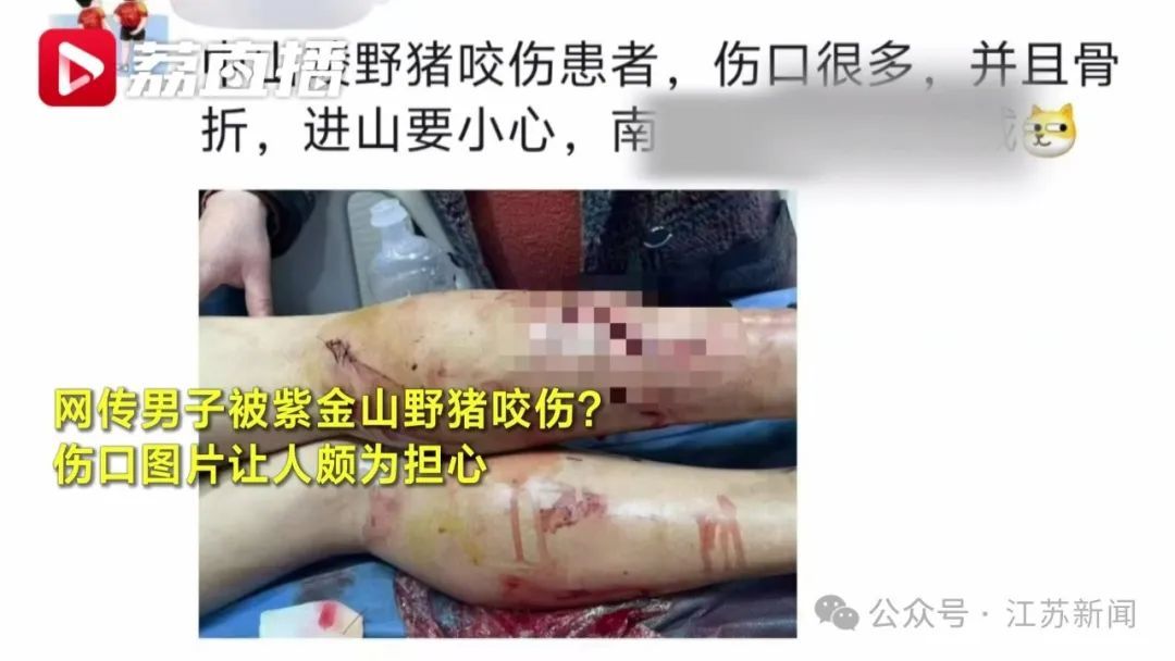 南京一男子被野猪咬伤骨折？真相来了