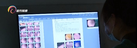 小心这种新上市的水果!吃多会恶心、胃胀、胃痛,严重可能要去洗胃...... 小心这种新上市的水果!吃多会恶心、胃胀、胃痛,严重可能要去洗胃......