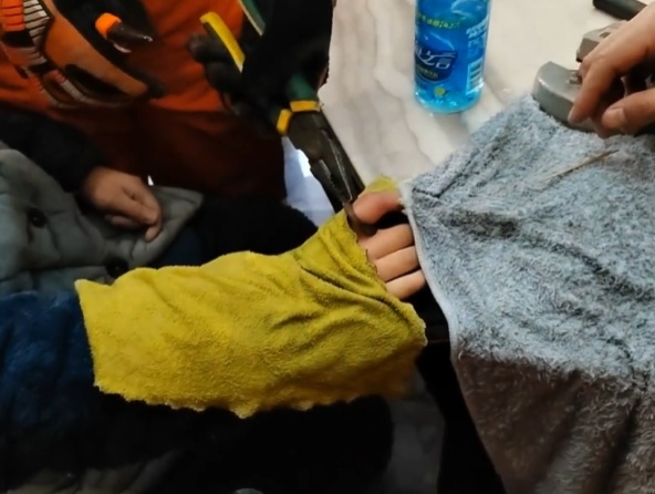 鸡毛毽子“下黑手”,男孩手指红肿告急! 鸡毛毽子“下黑手”,男孩手指红肿告急!