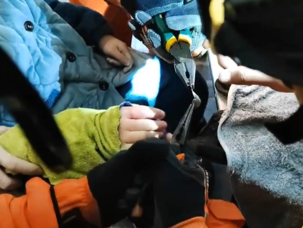 鸡毛毽子“下黑手”,男孩手指红肿告急! 鸡毛毽子“下黑手”,男孩手指红肿告急!