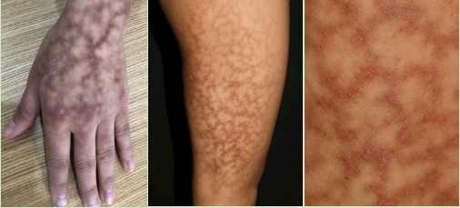 今晚起,睡觉时要注意!杭州已有人中招! 今晚起,睡觉时要注意!杭州已有人中招!