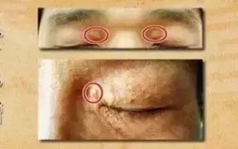 脸上有张“疾病地图”,哪里生病了,它都会“告诉”你!快对照看看 脸上有张“疾病地图”,哪里生病了,它都会“告诉”你!快对照看看