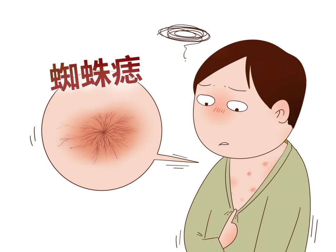 脸上有张“疾病地图”,哪里生病了,它都会“告诉”你!快对照看看 脸上有张“疾病地图”,哪里生病了,它都会“告诉”你!快对照看看