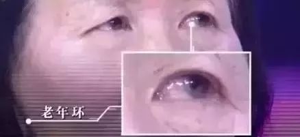 脸上有张“疾病地图”,哪里生病了,它都会“告诉”你!快对照看看 脸上有张“疾病地图”,哪里生病了,它都会“告诉”你!快对照看看