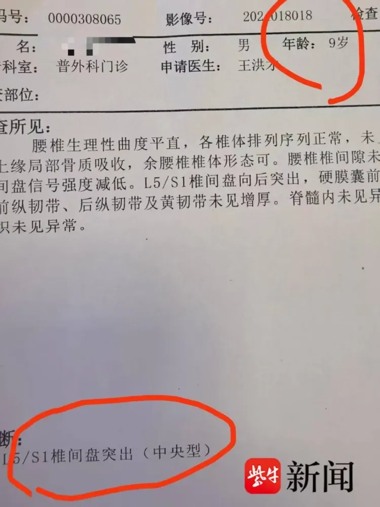 “这么小确实是比较少见！”9岁小男孩确诊腰椎间盘脱出……