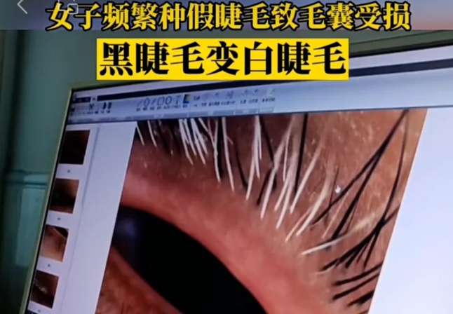 The six common senses that false eyelashes hide "beautiful" hidden dangers must be kept in mind.