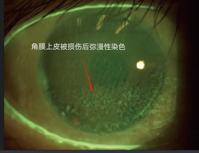 那些总戴假睫毛的人,现在都怎么样了? 那些总戴假睫毛的人,现在都怎么样了?