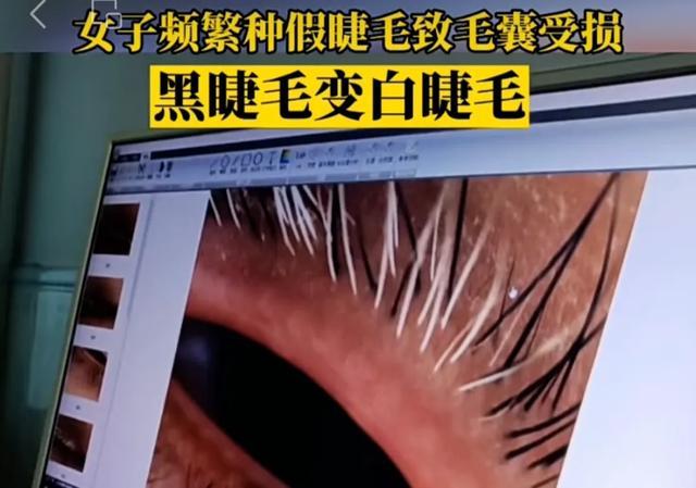 那些总戴假睫毛的人,现在都怎么样了? 那些总戴假睫毛的人,现在都怎么样了?