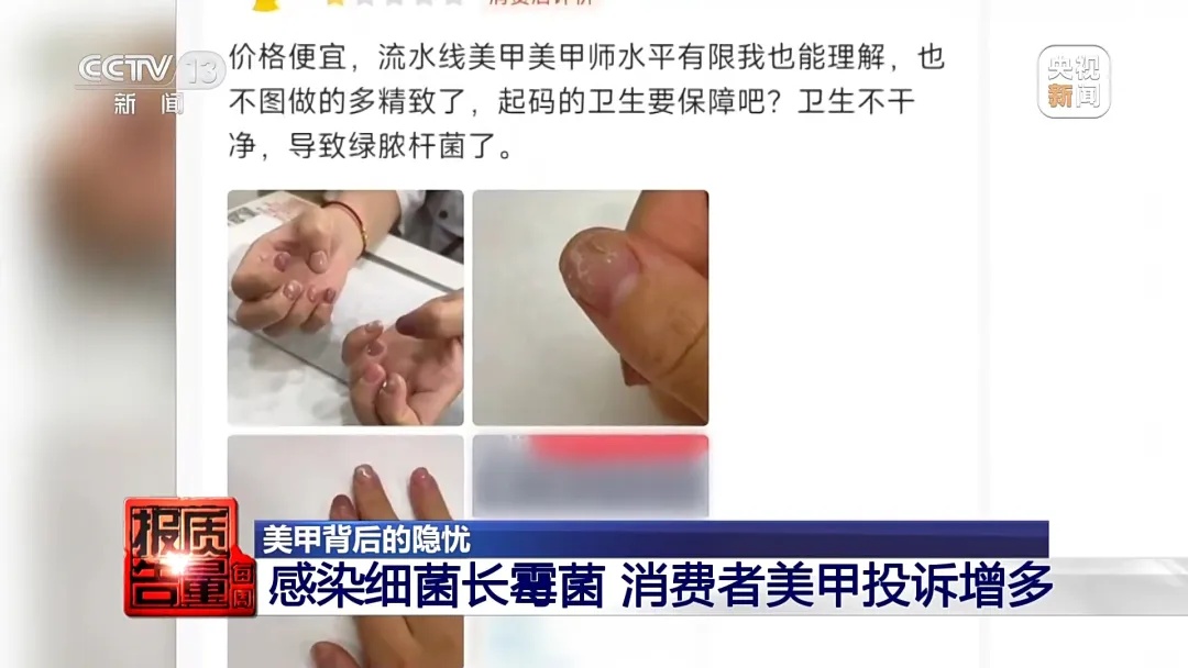 做美甲染上了HPV病毒？揭露美甲变“毁甲”背后的隐忧