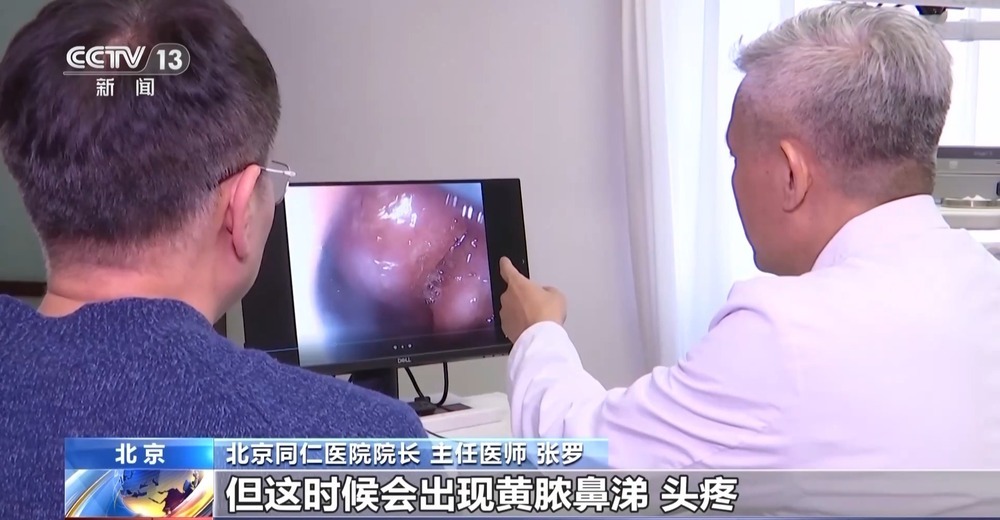 慢性鼻窦炎顽疾难愈 背后“真凶”是谁？