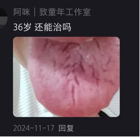 舌头上出现裂纹，是啥情况？