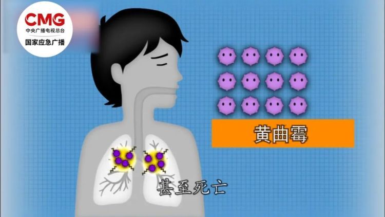 近期警惕!年前大扫除惹出这个病 这些细节别忽视 近期警惕!年前大扫除惹出这个病 这些细节别忽视