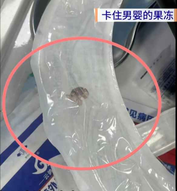 痛心！1岁男婴吃果冻窒息死亡，提醒：这些食物不要喂给孩子吃