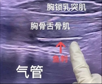 因为这道菜，有医生除夕夜接诊近20人！几乎家家桌上都有