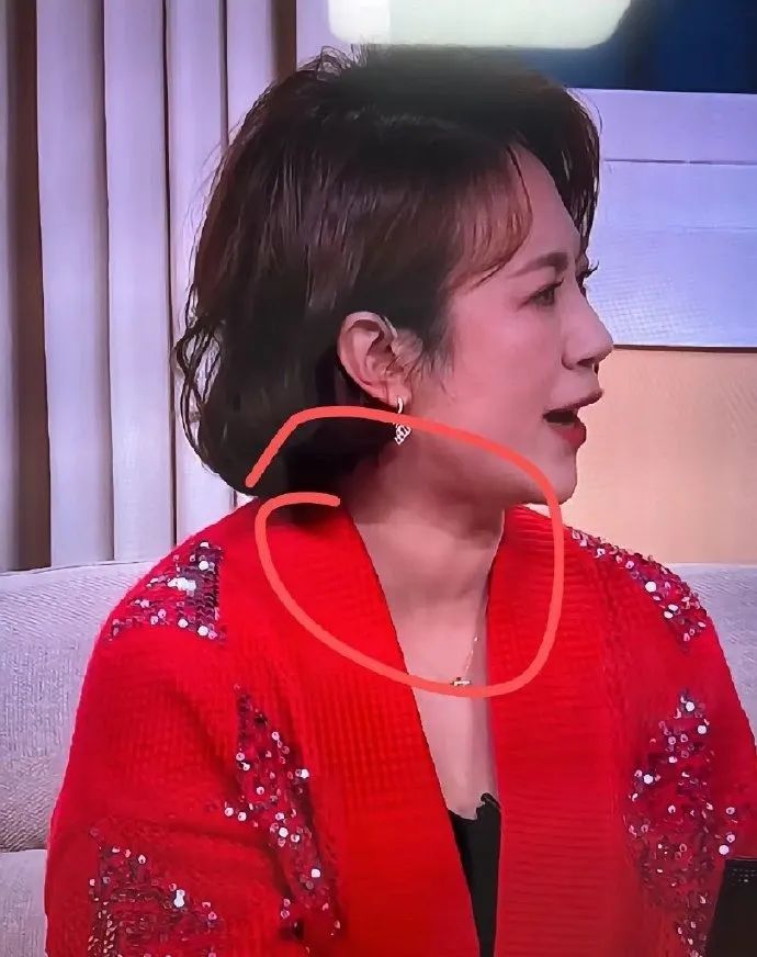 “马丽甲状腺”热搜第一!眼尖的网友着急喊话!本人曾回应 “马丽甲状腺”热搜第一!眼尖的网友着急喊话!本人曾回应