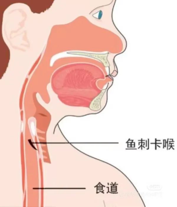 每天都有！医生忙到手软，都是这种情况！春节高发，赶紧提醒家人...