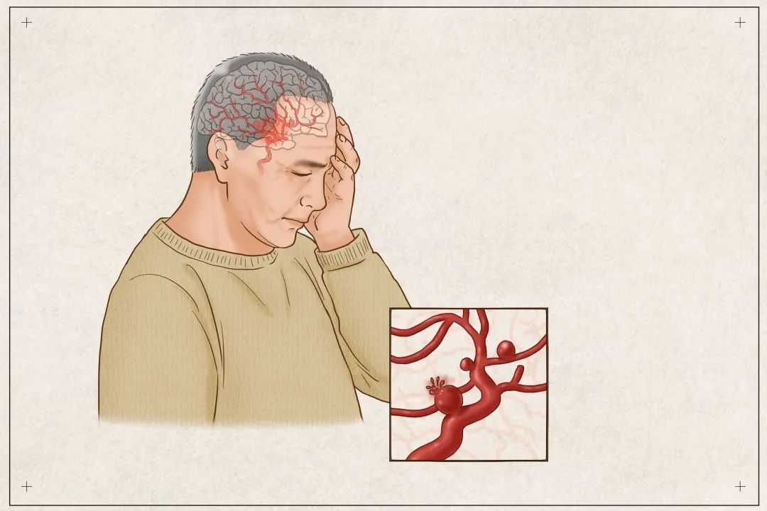 太可怕!知名女演员突然确诊 “一旦破裂,死亡率极高” 太可怕!知名女演员突然确诊 “一旦破裂,死亡率极高”