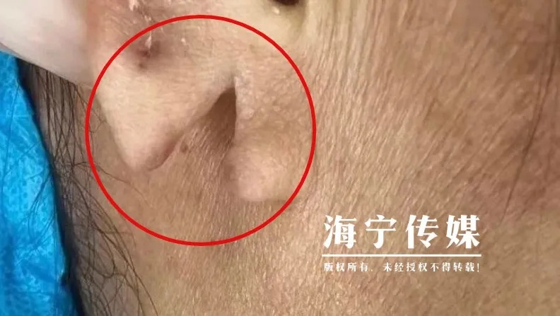 裂开！太疼了！浙江女子早上起床后，发现吓人一幕……