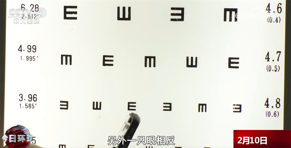 双眼近视相差400度或因侧躺刷手机 警惕：这些生活习惯很伤眼！