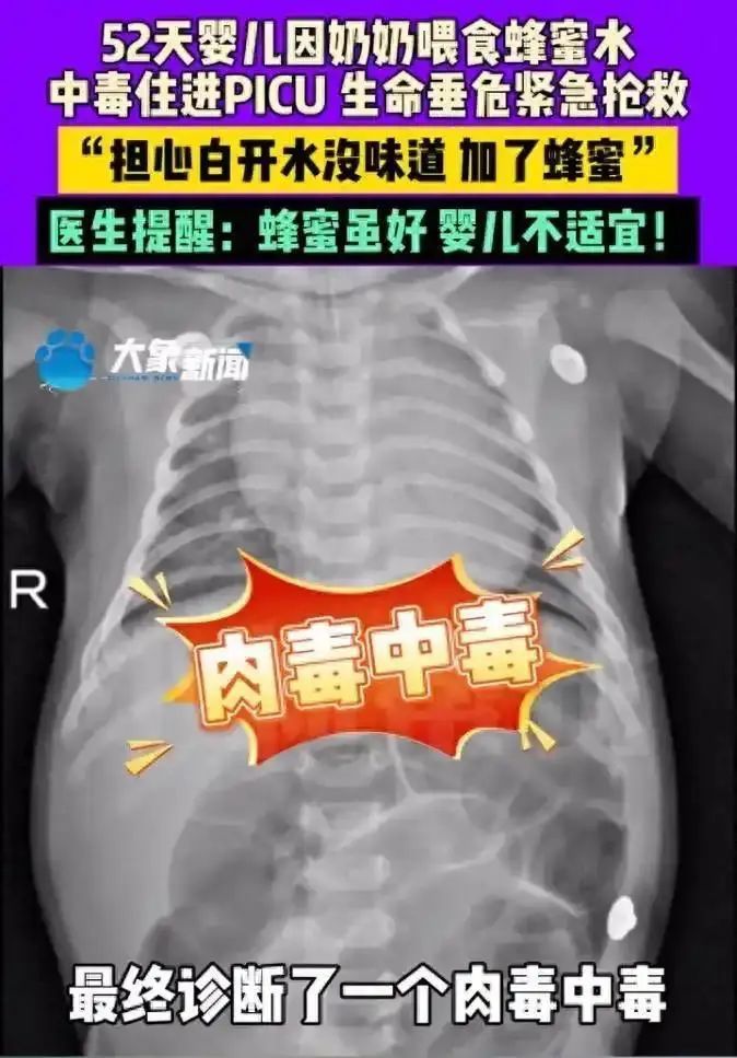 揪心！52天宝宝进ICU！只因奶奶这个举动……