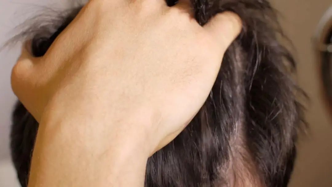 起初只是做了98元的护理，程序员竟背上巨额债务！三个月充卡近24万…