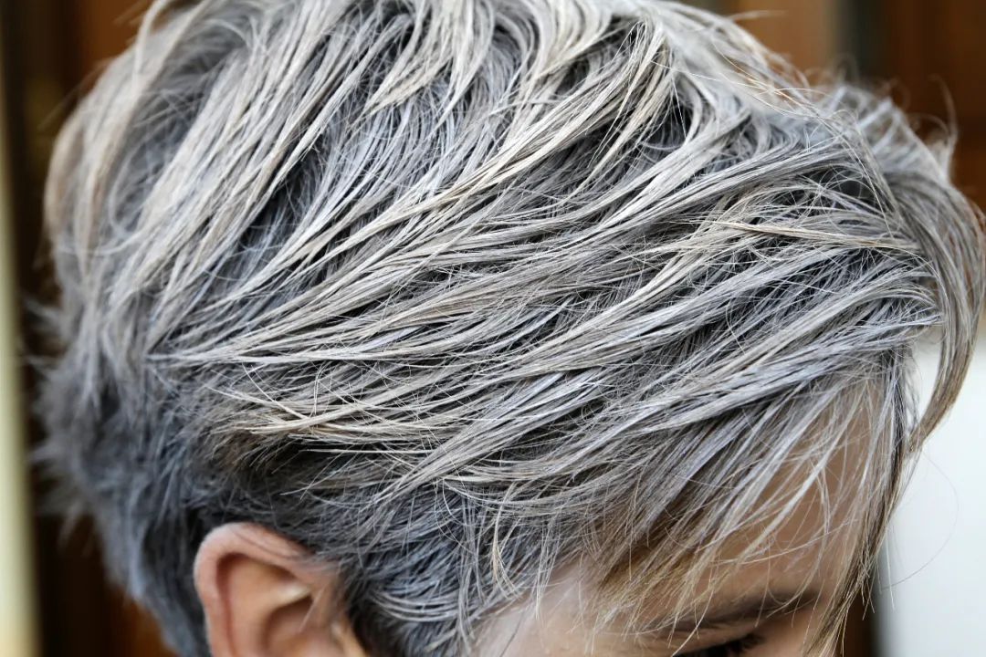 缺乏这些营养素，白发长得快！这样做预防白发早生~