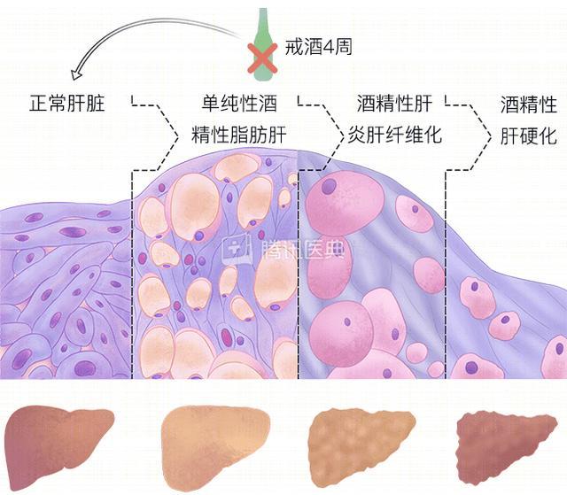 喝酒脸红的人，酒量更大？