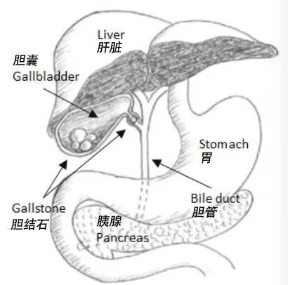 饭后突然肚子疼，警惕是这种会要命的病！最近高发