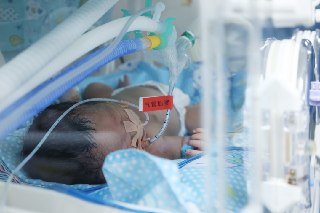从1.54kg到2.55kg!早产儿小安安平安“闯关” 从1.54kg到2.55kg!早产儿小安安平安“闯关”
