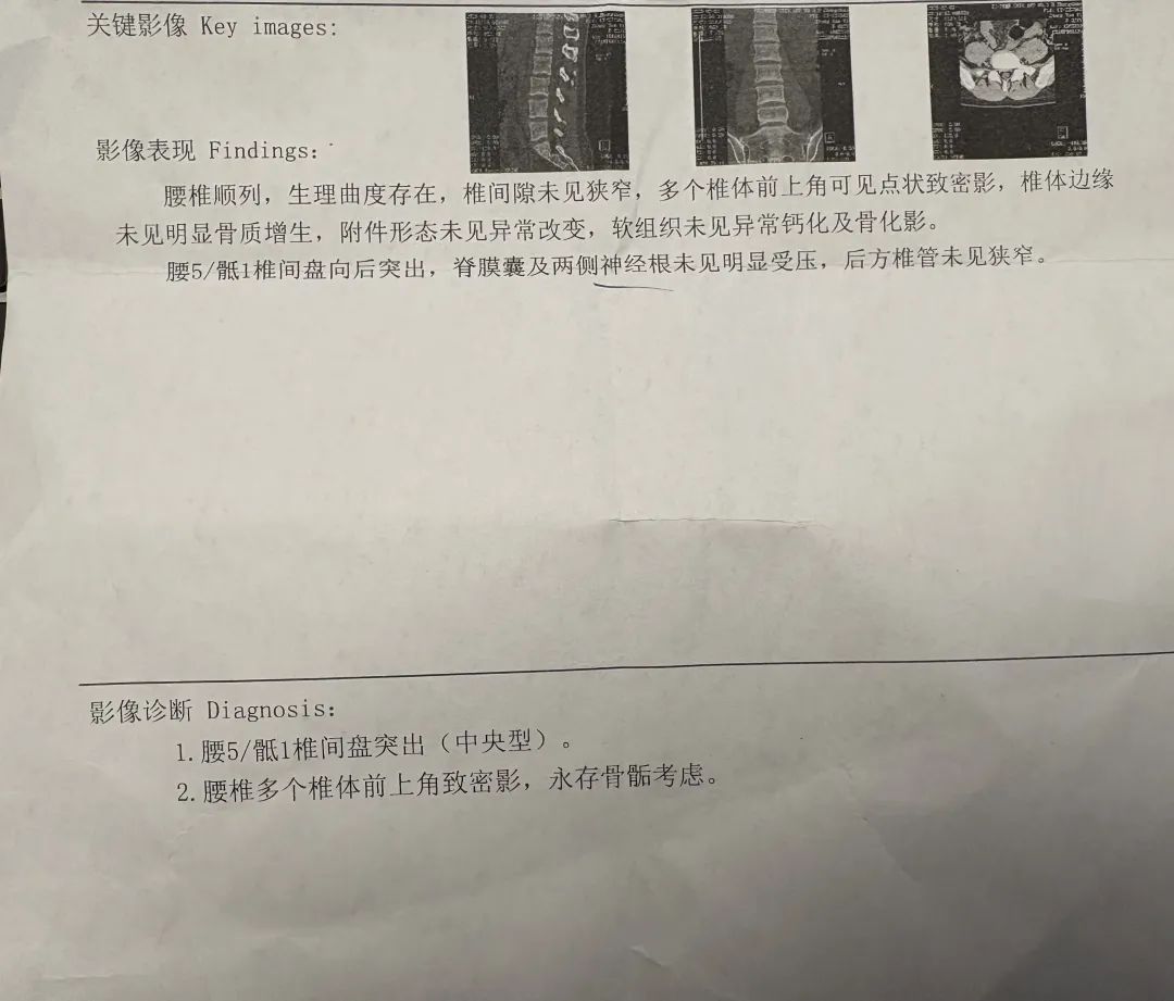 杭州一27岁女子摔跤后被确诊…妈妈崩溃：这么年轻怎么会？