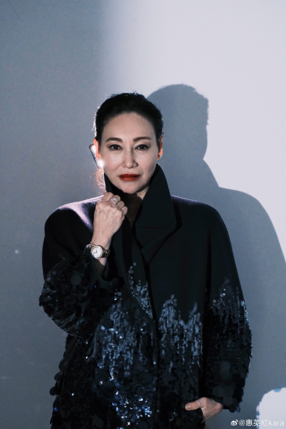 65岁影后公开谈演员整容问题，承认脸上缝过89针，称要“勇敢说出来”