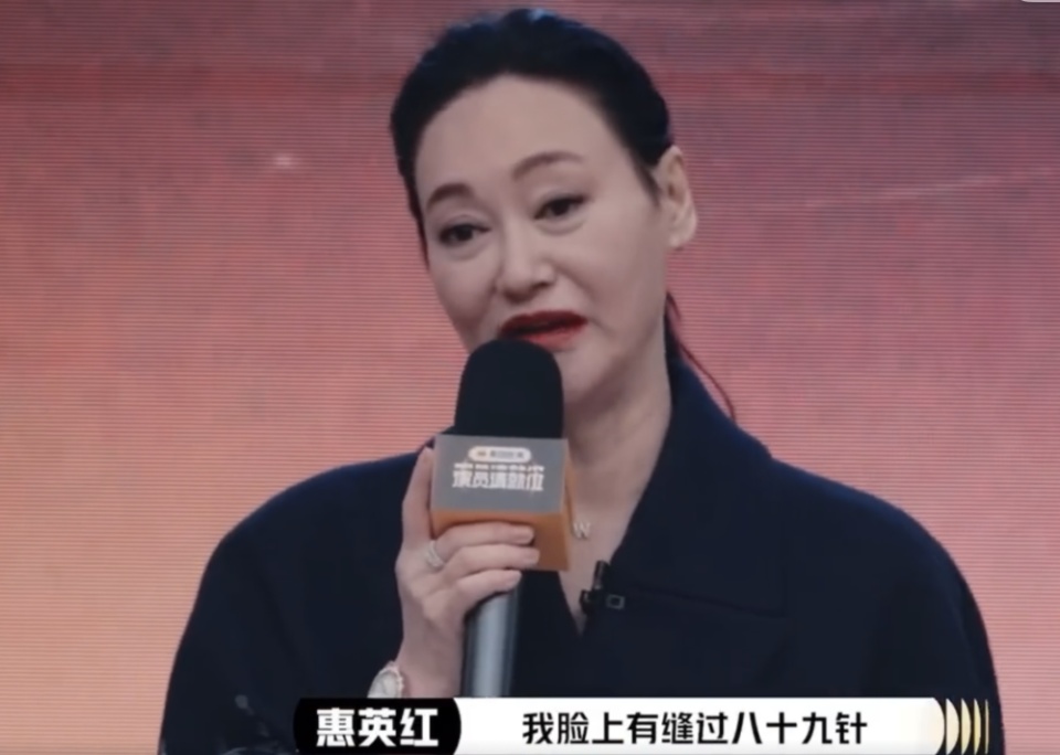 65岁影后公开谈演员整容问题，承认脸上缝过89针，称要“勇敢说出来”