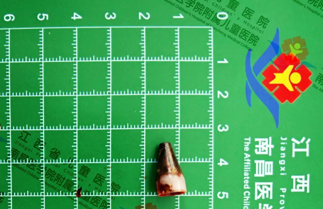 9岁男孩肺部感染咳嗽数月，医生竟在肺里发现……好多孩子都有这个习惯！