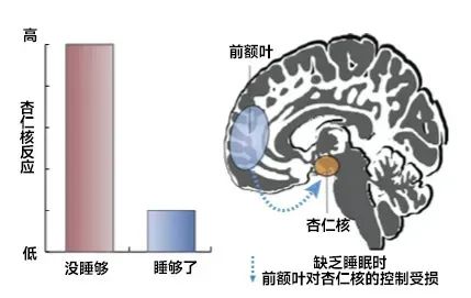 你认为正常的几种表现，却是严重缺觉！