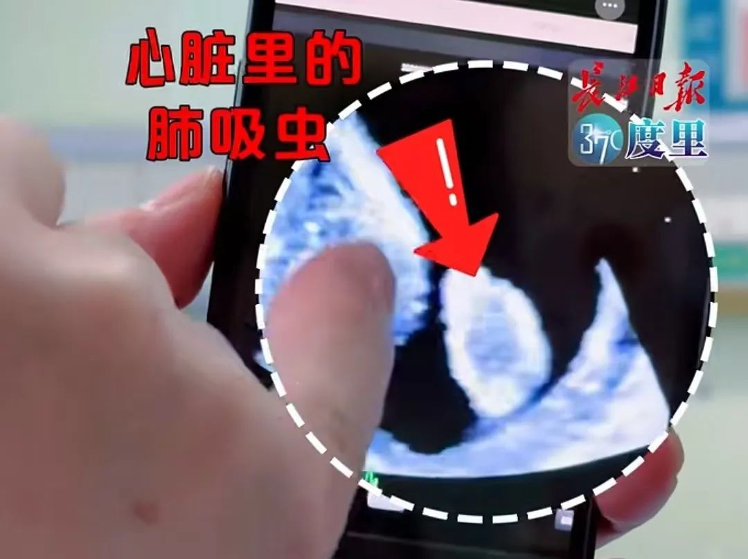 10岁男童被这种虫钻进心脏,画面惊悚!只因3年前一个举动 10岁男童被这种虫钻进心脏,画面惊悚!只因3年前一个举动