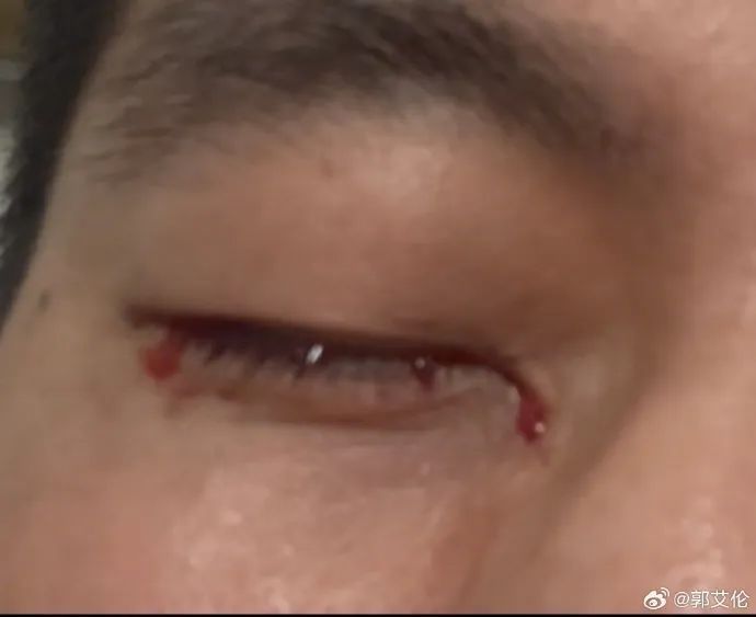 知名运动员发声：毁了我一辈子，很绝望！