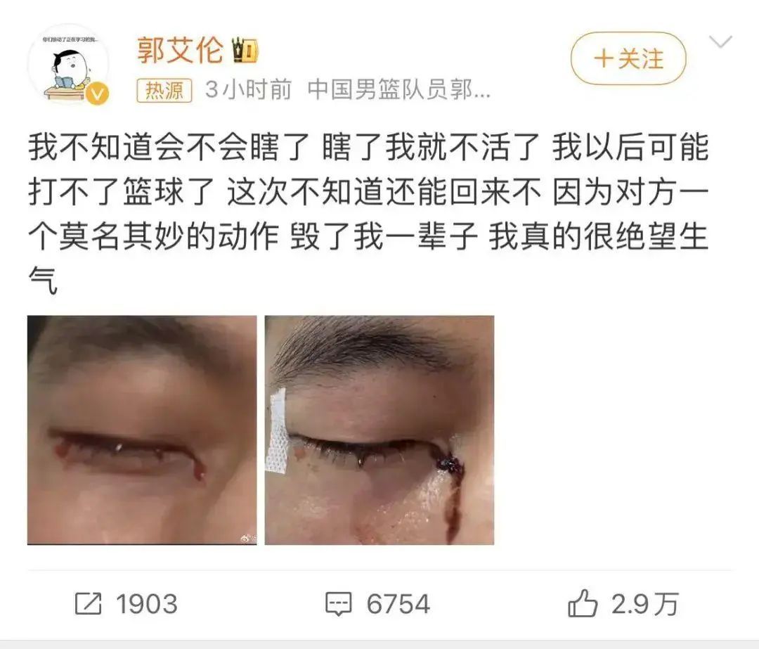 “郭艾伦眼睛受伤缝40多针”，俱乐部最新回应！陶勇医生深夜发文