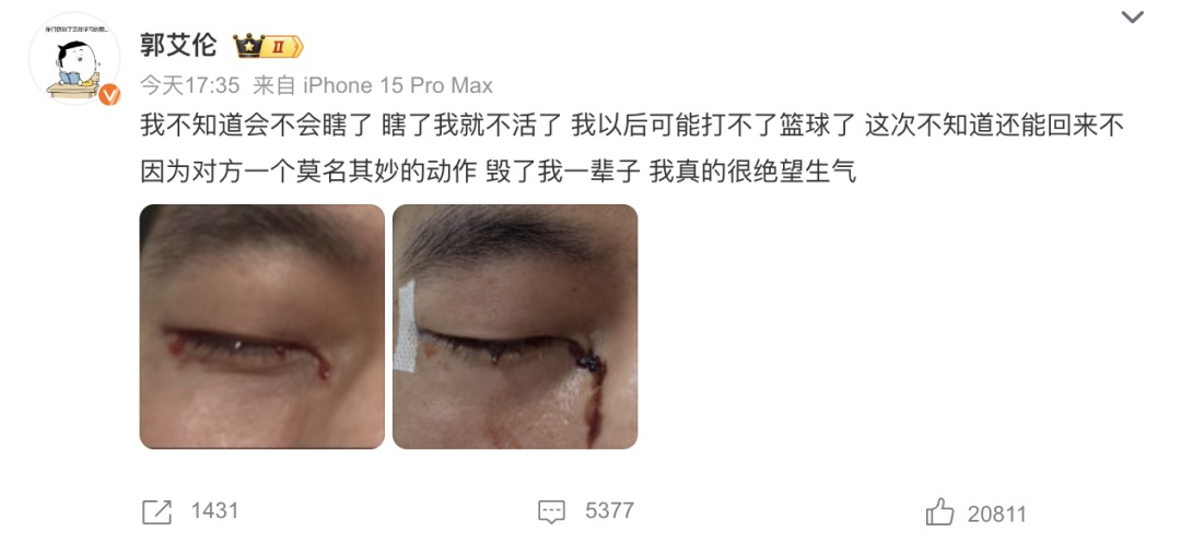 郭艾伦突发意外：被手指扎进眼珠，缝了40多针！广州男篮回应