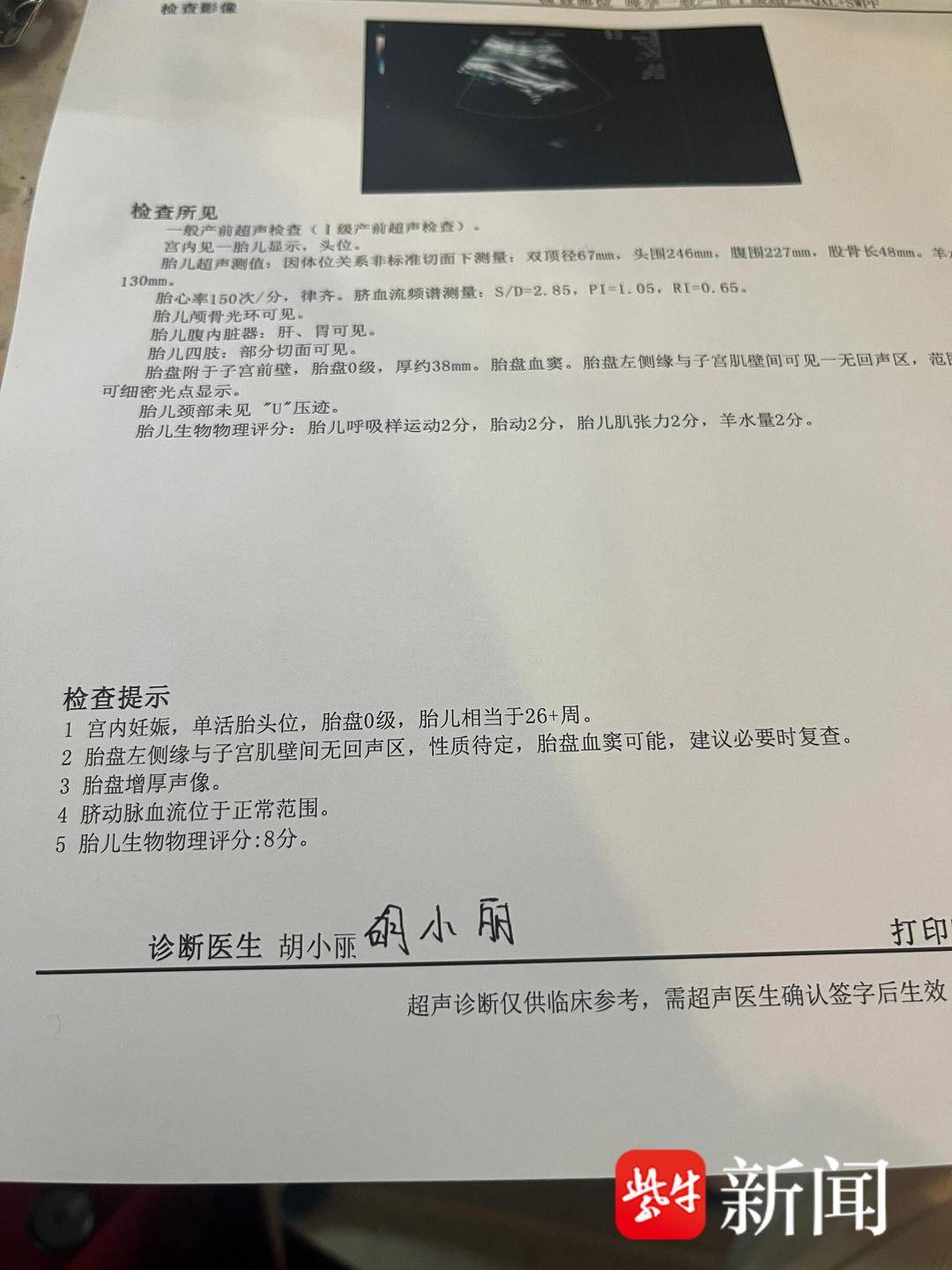 被行李箱砸中孕妇已起诉两方责任人，律师：行李人和铁路局均可能承担侵权责任