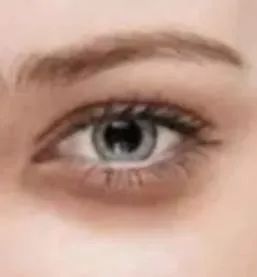 如何避免哪吒同款黑眼圈？