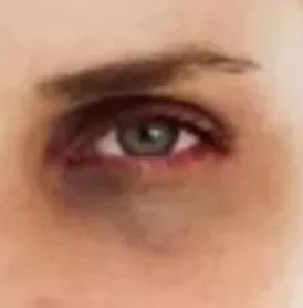 如何避免哪吒同款黑眼圈？