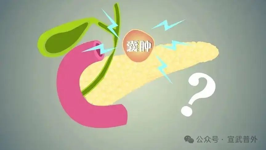 得了胰腺囊肿怎么办？