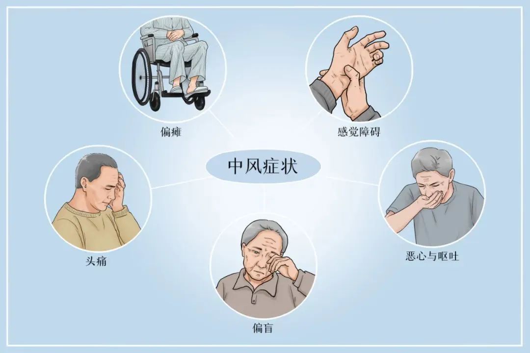睡前有这5种表现，可能是脑梗