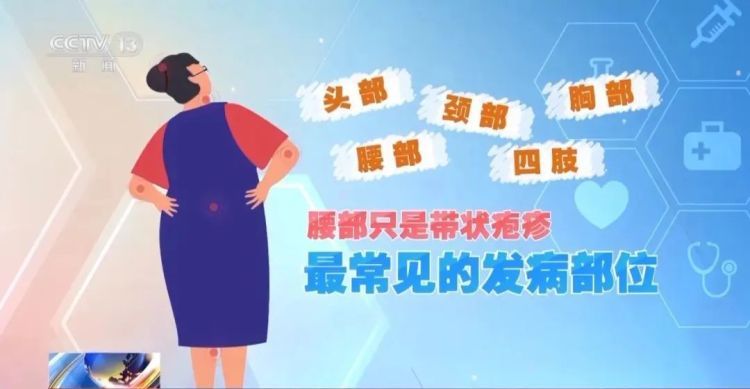 一旦感染终身携带，有人疼了40年！到底要怎么防？